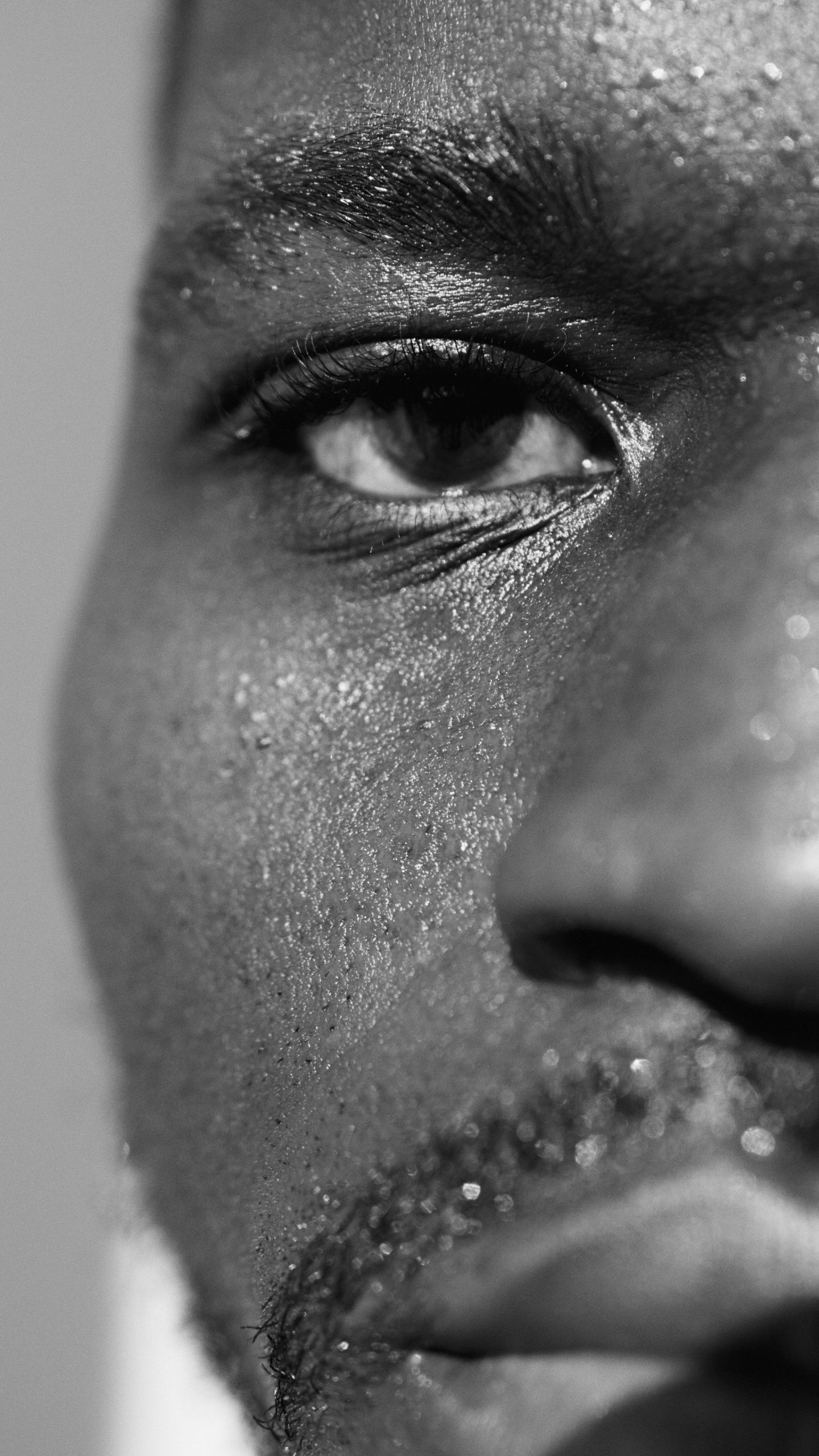 Comment soigner l&rsquo;hyperpigmentation sur peau noire ?