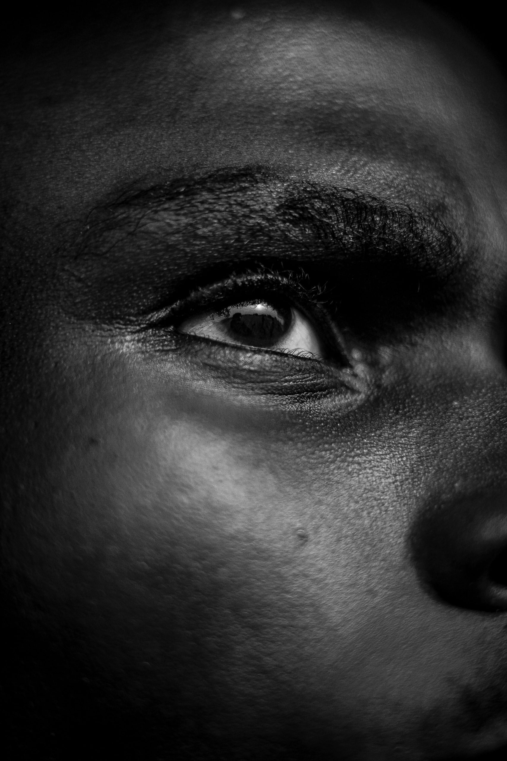 Traitement hyperpigmentation peau noire