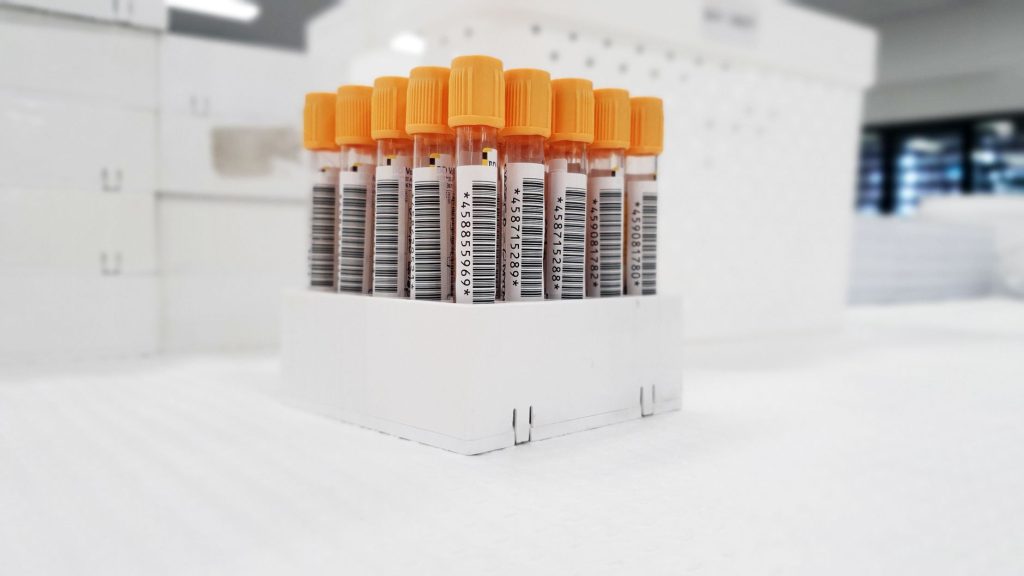 Tubes de prelevement sanguin en laboratoire