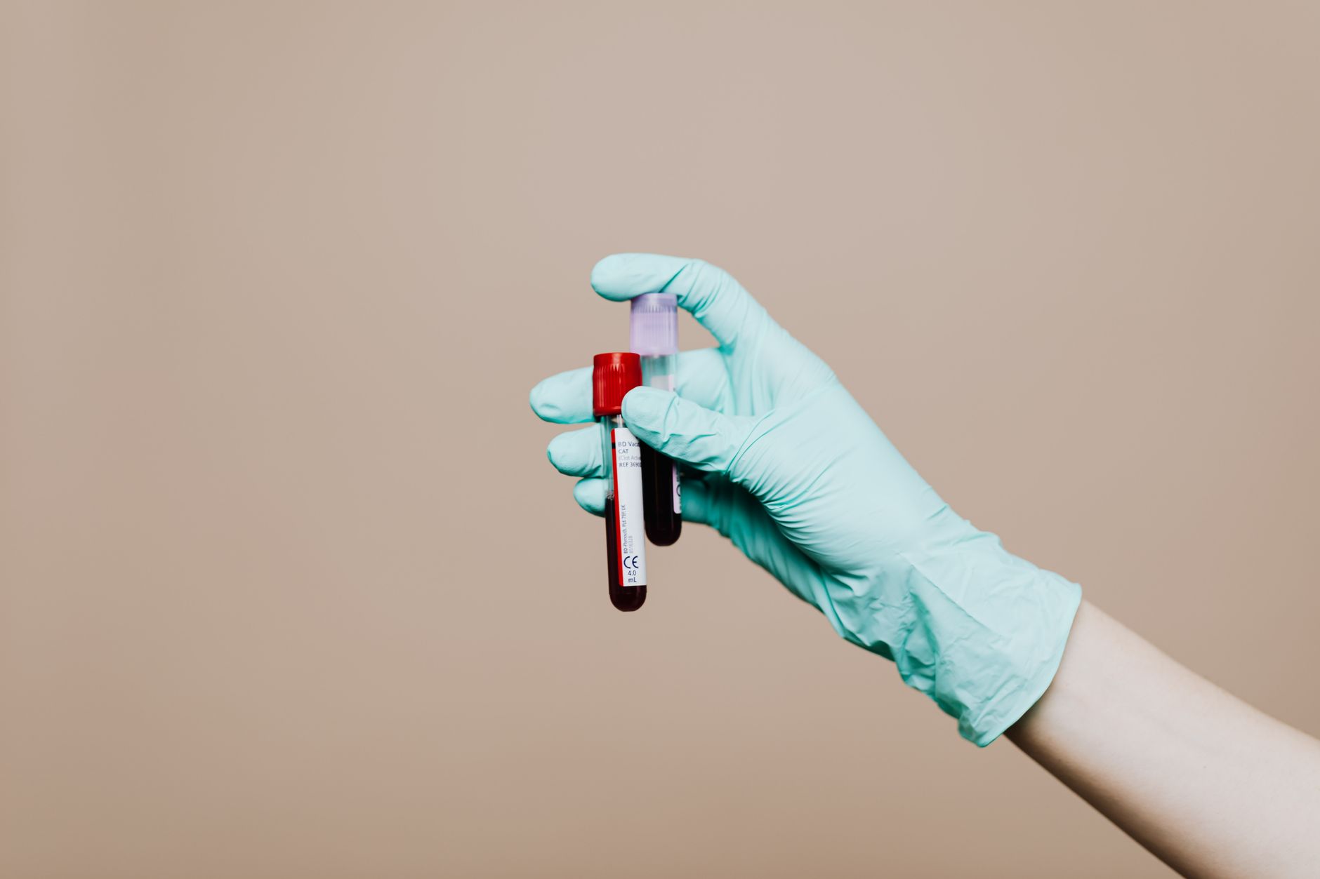 Tubes de prelevement sanguin en laboratoire